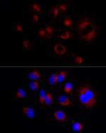 LAMP2 Antibody in Immunocytochemistry (ICC/IF)