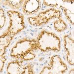 LAMP2 Antibody in Immunohistochemistry (Paraffin) (IHC (P))