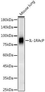 IL-1RAcP Antibody in Western Blot (WB)