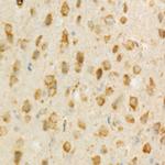 TSG101 Antibody in Immunohistochemistry (Paraffin) (IHC (P))