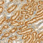 TSG101 Antibody in Immunohistochemistry (Paraffin) (IHC (P))