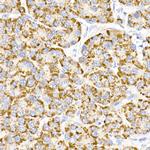 MMP3 Antibody in Immunohistochemistry (Paraffin) (IHC (P))