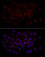 Beclin 1 Antibody in Immunocytochemistry (ICC/IF)