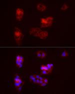 Beclin 1 Antibody in Immunocytochemistry (ICC/IF)