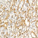 TGFBI Antibody in Immunohistochemistry (Paraffin) (IHC (P))