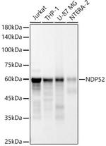 CALCOCO2 Antibody in Western Blot (WB)