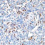 CDA Antibody in Immunohistochemistry (Paraffin) (IHC (P))