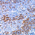 CDA Antibody in Immunohistochemistry (Paraffin) (IHC (P))