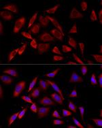 PKC alpha Antibody in Immunocytochemistry (ICC/IF)