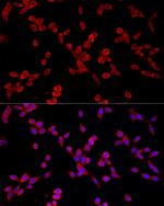 PKC alpha Antibody in Immunocytochemistry (ICC/IF)