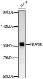 NUP98 Antibody in Western Blot (WB)