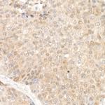 SOD1 Antibody in Immunohistochemistry (Paraffin) (IHC (P))