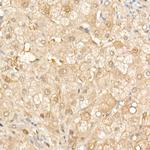 SOD1 Antibody in Immunohistochemistry (Paraffin) (IHC (P))