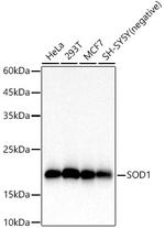 SOD1 Antibody in Western Blot (WB)