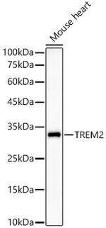 TREM2 Antibody in Western Blot (WB)