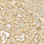 BST-2 Antibody in Immunohistochemistry (Paraffin) (IHC (P))