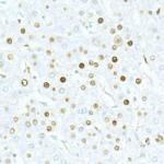 MCM2 Antibody in Immunohistochemistry (Paraffin) (IHC (P))