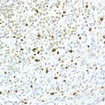 MCM2 Antibody in Immunohistochemistry (Paraffin) (IHC (P))