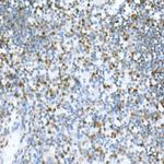 MCM2 Antibody in Immunohistochemistry (Paraffin) (IHC (P))