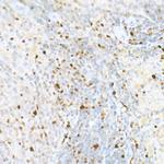 MCM2 Antibody in Immunohistochemistry (Paraffin) (IHC (P))