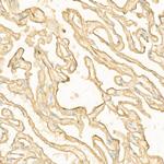 S100A10 Antibody in Immunohistochemistry (Paraffin) (IHC (P))