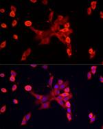 S100A10 Antibody in Immunohistochemistry (Paraffin) (IHC (P))