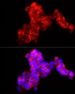 MMP2 Antibody in Immunocytochemistry (ICC/IF)