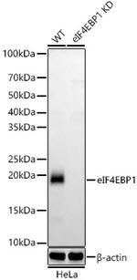 4EBP1 Antibody in Western Blot (WB)