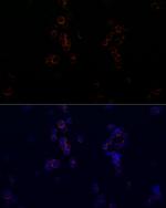 CD162 Antibody in Immunocytochemistry (ICC/IF)