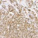 CD162 Antibody in Immunohistochemistry (Paraffin) (IHC (P))