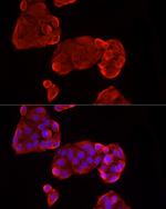 Glypican 3 Antibody in Immunocytochemistry (ICC/IF)