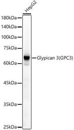 Glypican 3 Antibody in Western Blot (WB)