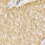 GRP78 Antibody in Immunohistochemistry (Paraffin) (IHC (P))