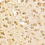 GRP78 Antibody in Immunohistochemistry (Paraffin) (IHC (P))