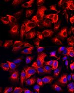 Cytokeratin 17 Antibody in Immunocytochemistry (ICC/IF)