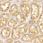 EEF1A1 Antibody in Immunohistochemistry (Paraffin) (IHC (P))