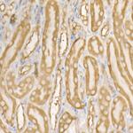 EEF1A1 Antibody in Immunohistochemistry (Paraffin) (IHC (P))