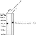 FAP Antibody in Western Blot (WB)