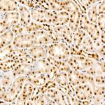 Phospho-AKT Pan (Thr450, Thr451, Thr447) Antibody in Immunohistochemistry (Paraffin) (IHC (P))