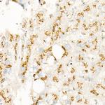 p70 S6 Kinase Antibody in Immunohistochemistry (Paraffin) (IHC (P))