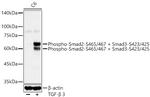 Phospho-SMAD2/SMAD3 (Ser465, Ser467, Ser423, Ser425) Antibody in Western Blot (WB)