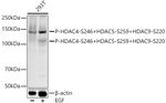 Phospho-HDAC4/HDAC5/HDAC9 (Ser246, Ser259, Ser220) Antibody in Western Blot (WB)