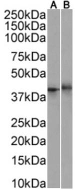 CD137 Chimeric Antibody in Western Blot (WB)