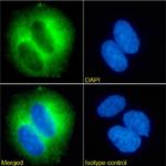 TRAIL-R2 (DR5) Chimeric Antibody in Immunocytochemistry (ICC/IF)