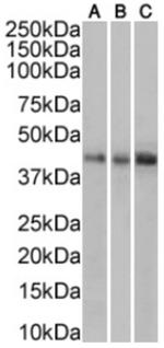 TRAIL-R2 (DR5) Chimeric Antibody in Western Blot (WB)