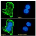 Mesothelin Chimeric Antibody in Immunocytochemistry (ICC/IF)