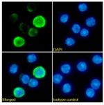 TCR alpha/beta Chimeric Antibody in Immunocytochemistry (ICC/IF)