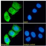 MUC1 Chimeric Antibody in Immunocytochemistry (ICC/IF)