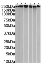 MUC1 Chimeric Antibody in Western Blot (WB)