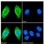 p21 Chimeric Antibody in Immunocytochemistry (ICC/IF)